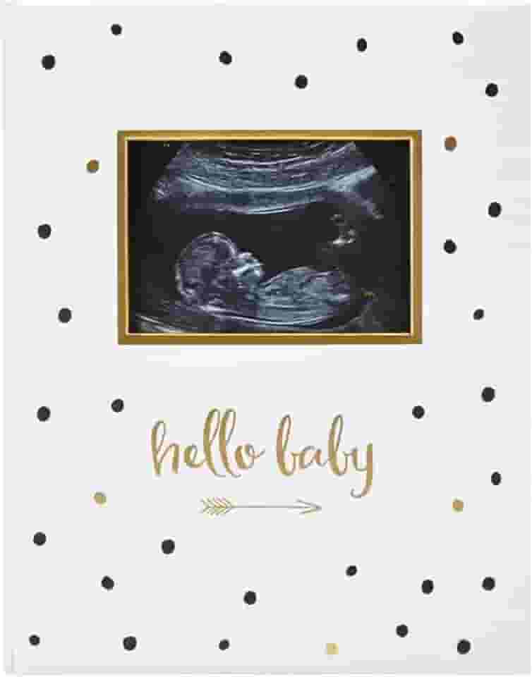 Livro de memórias do bebê Pearhead, para os primeiros 5 anos, poá preto/dourado