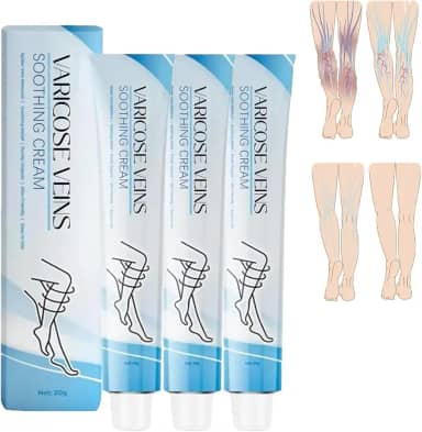 Tratamento Para Varizes Nas Pernas, Creme - Melhora A Circulação Sanguínea, Reduz O Peso (3 Unidades)